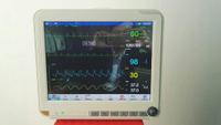 Equipo médico HM-2000E Monitor de paciente multiparámetro portátil ECG de 15 pulgadas