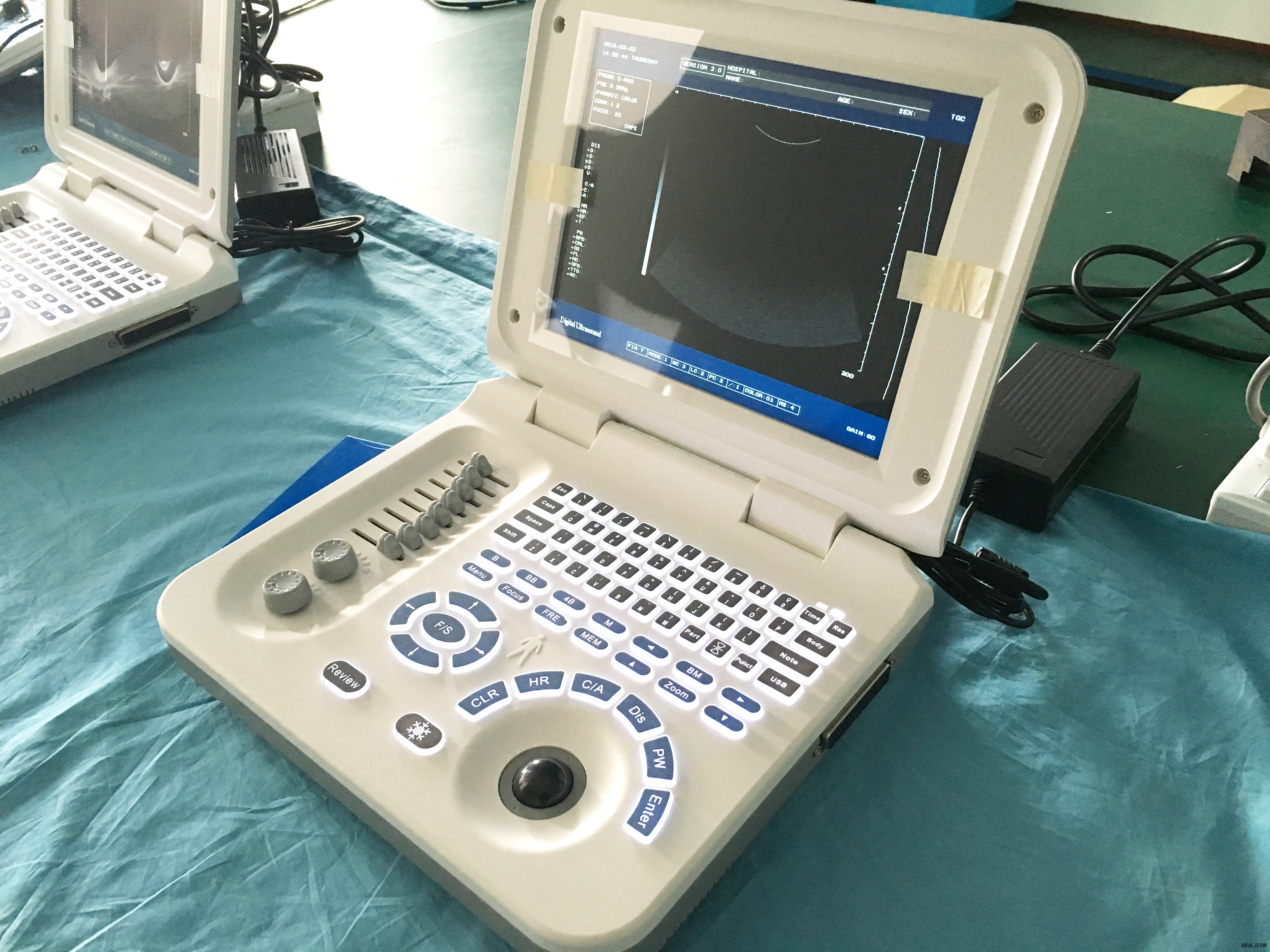 Máquina portátil del escáner de ultrasonido 3D del equipo de diagnóstico de la venta caliente HBW-3