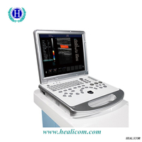 Equipo médico HUC-250 máquina de escáner de ultrasonido Doppler color portátil