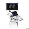 Máquina de ultrasonido Sonoscape P25 2D / 3D / 4D de alta calidad / escáner de ultrasonido Doppler color