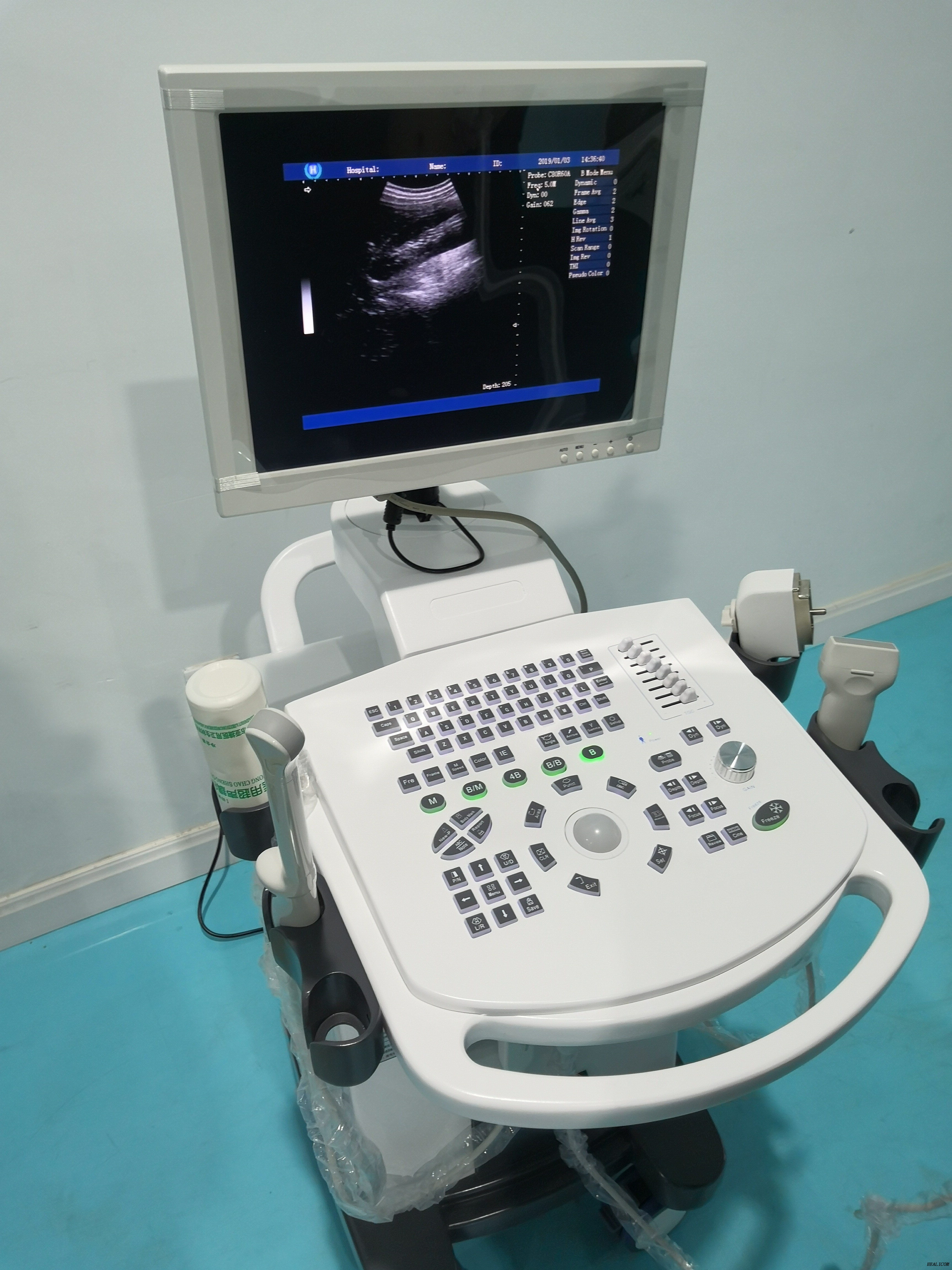 Equipo médico de precio competitivo HBW-10 Plus Escáner de ultrasonido portátil digital completo con carro