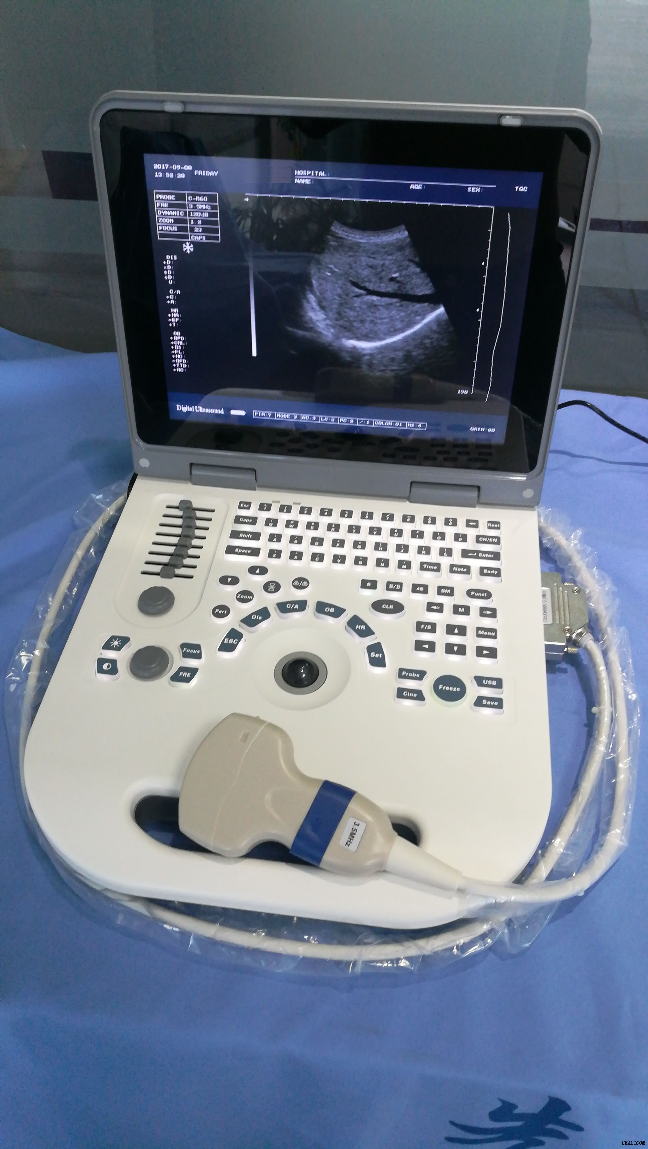 Equipo de diagnóstico HBW-3 Plus Ultrasonido portátil completamente digital portátil