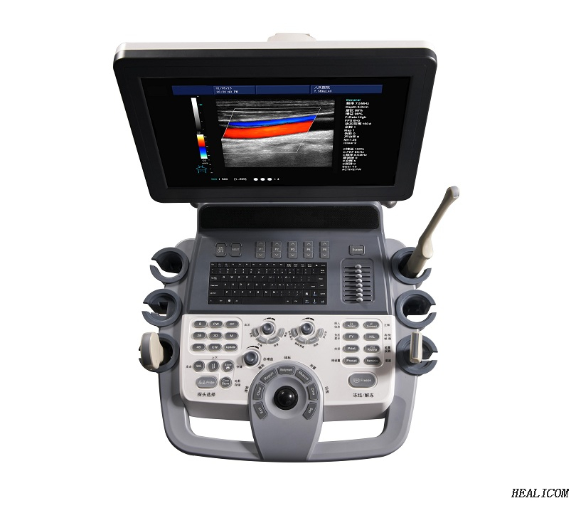 Máquina de ultrasonido 4D Huc-800 de terapia de imagen digital médica usg superior en salud y medicina