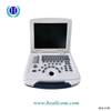 Dispositivo de diagnóstico médico hospitalario HBW-4, máquina de ultrasonido portátil en blanco y negro, escáner de ultrasonido USB 2d digital completo portátil de mano