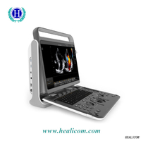 Sistema de diagnóstico HUC-590 Ecógrafo digital portátil Doppler color 3D 4D Sistema de diagnóstico HUC-590 Ecógrafo digital portátil Doppler color 3D 4D